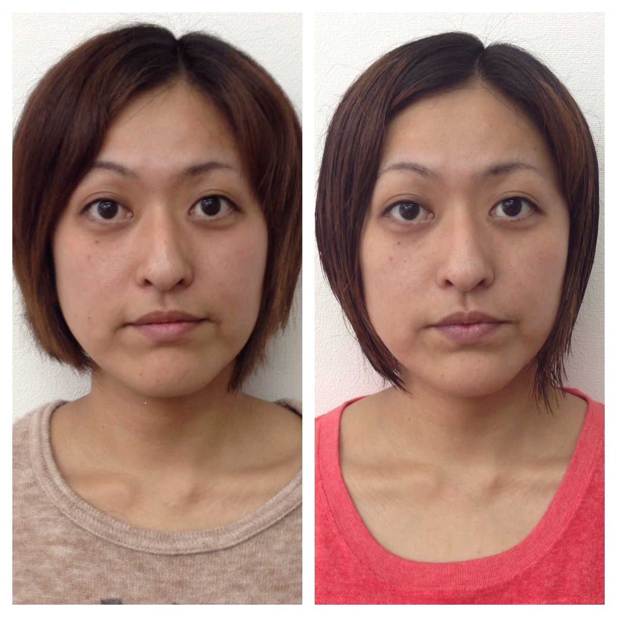 美肌小顔矯正 佐賀県唐津市にある整体院 がばい整体院 佐賀県唐津市